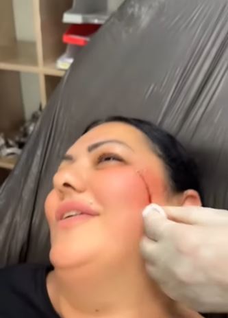 Zabrinjavajući video kruži društvenim mrežama: Lice pevačice krvavo, evo šta se dogodilo FOTO 5 1 1