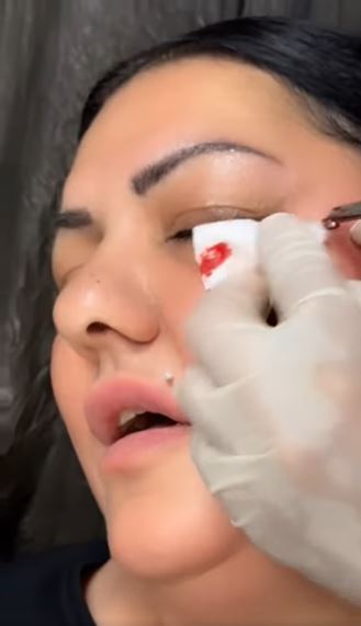 Zabrinjavajući video kruži društvenim mrežama: Lice pevačice krvavo, evo šta se dogodilo FOTO 6 2 1
