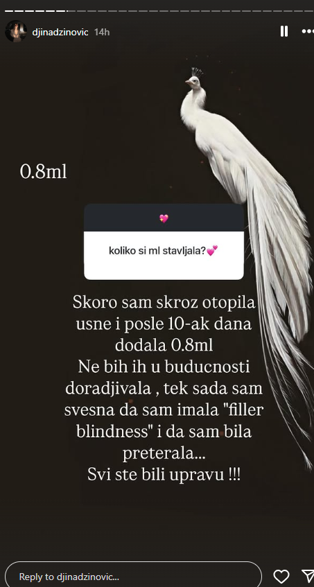 Htela kukove kao Kim Kardašijan, pa završila nezadovoljna, Đina Džinović priznala grešku: "Preterala sam" 6 Screenshot 2025 05 22 094309