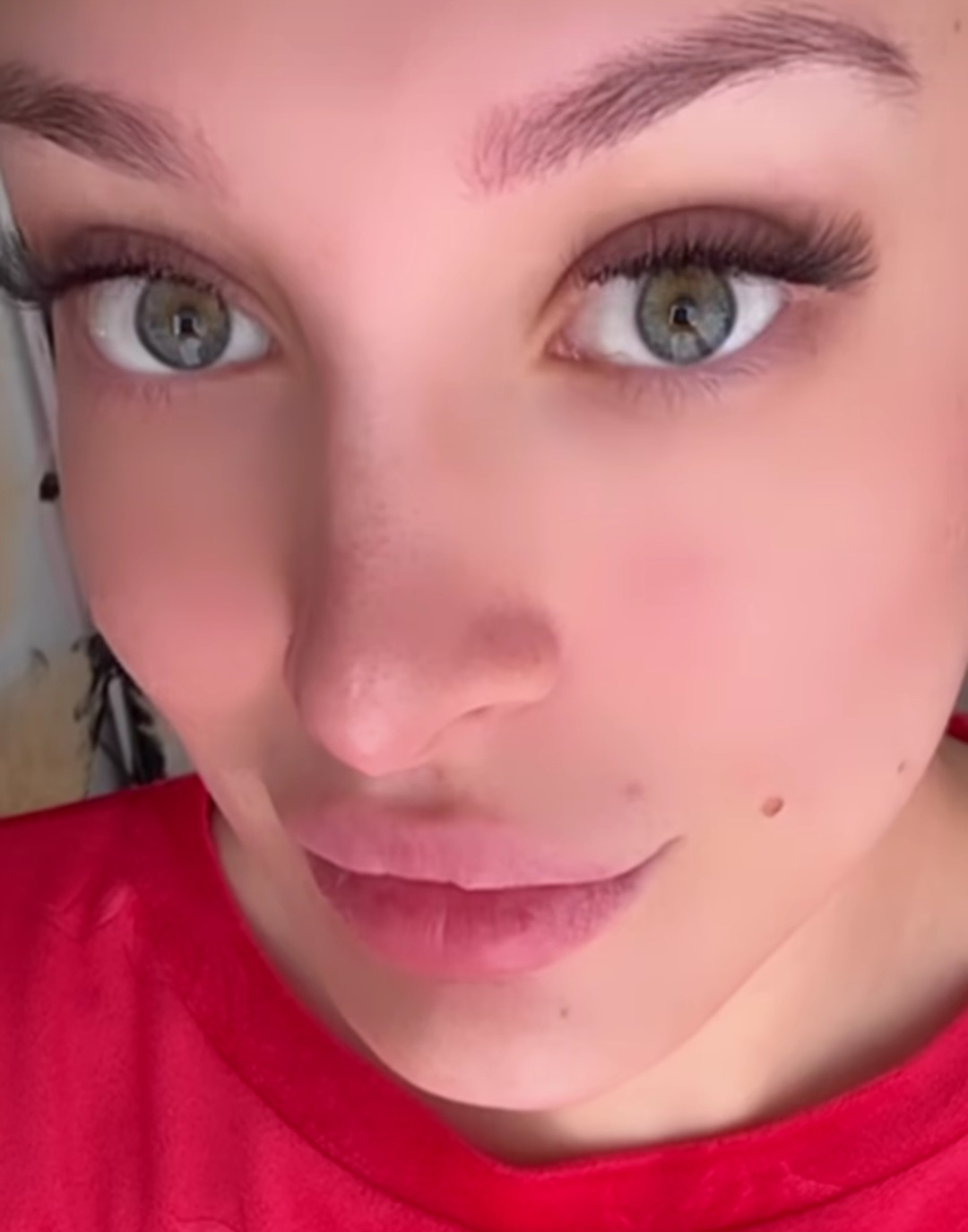 Oglasila se Luna Đogani nakon operacije, evo kako se sad oseća 6 Screenshot 20250512 210310 Instagram