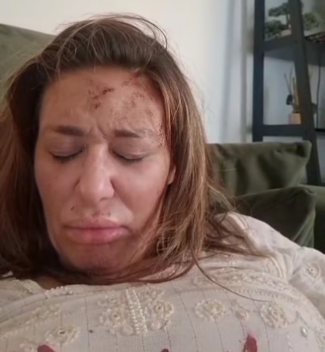 "Prebio me je, ide mi krv sa svih strana" Ana Nikolić prijavila Raleta za nasilje i objavila jeziv snimak, oglasio se i kompozitor VIDEO 6 Ana Nikolic 3