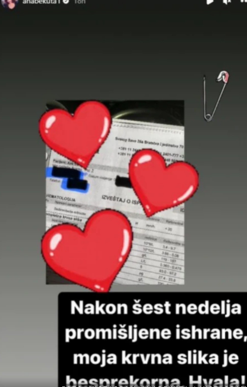 Ana Bekuta se oglasila na mrežama, objasnila zašto je morala u bolnicu 7 Ana Bekuta 1