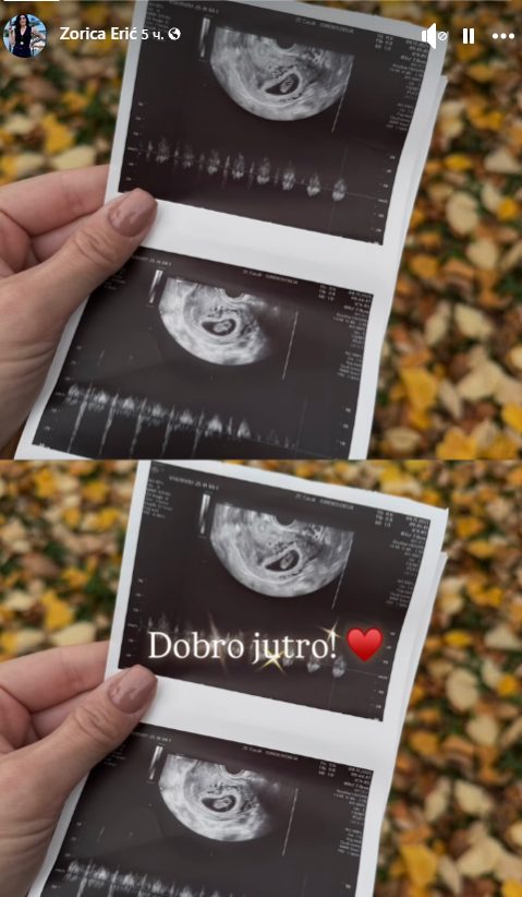 Zorica Erić postaje baba po drugi put 7 zorica eric postaje baba