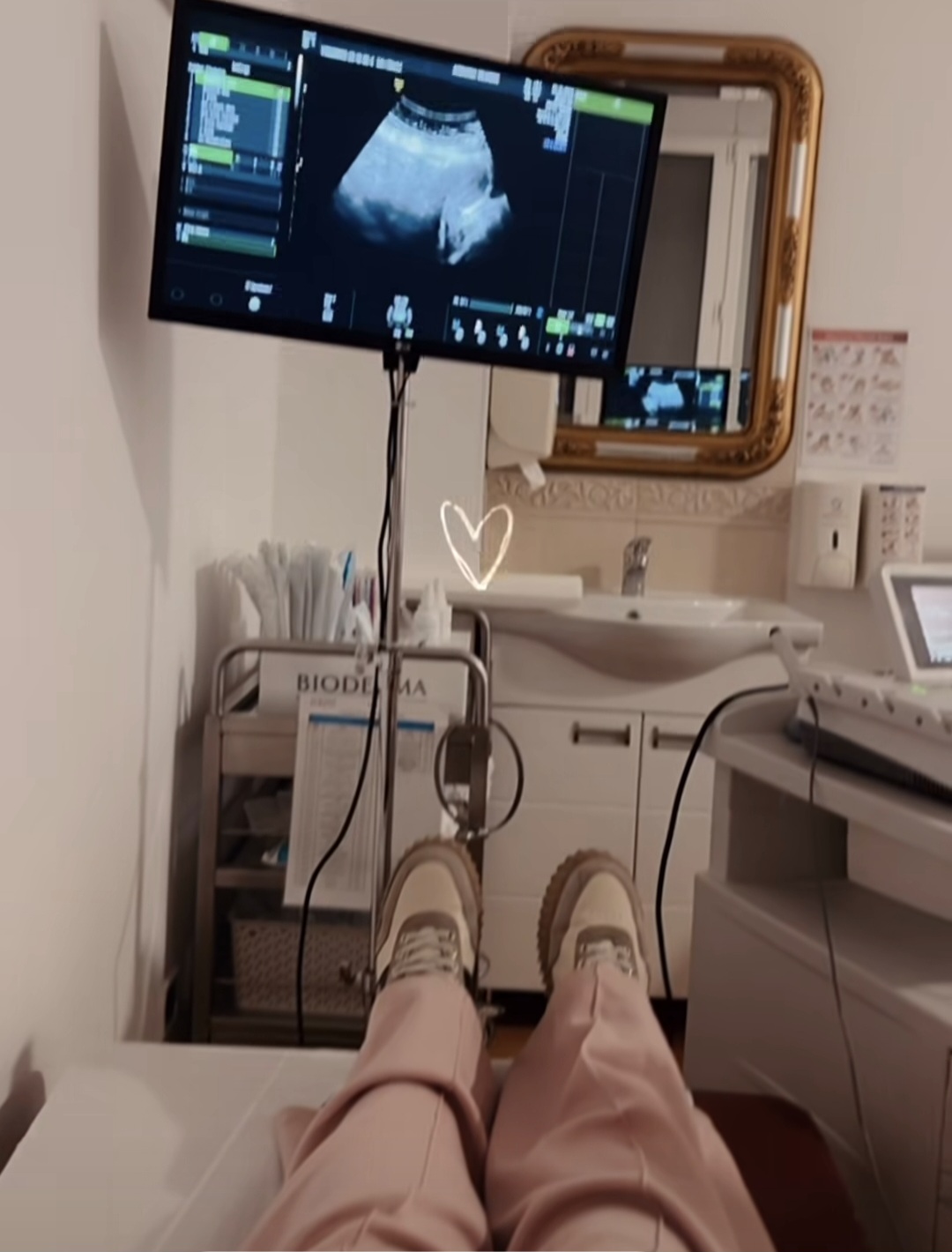 Aleksandra Bursać (37) objavila video sa ultrazvuka, mlađani suprug se ne odvaja od nje 6 Screenshot 20251202 142924 Instagram