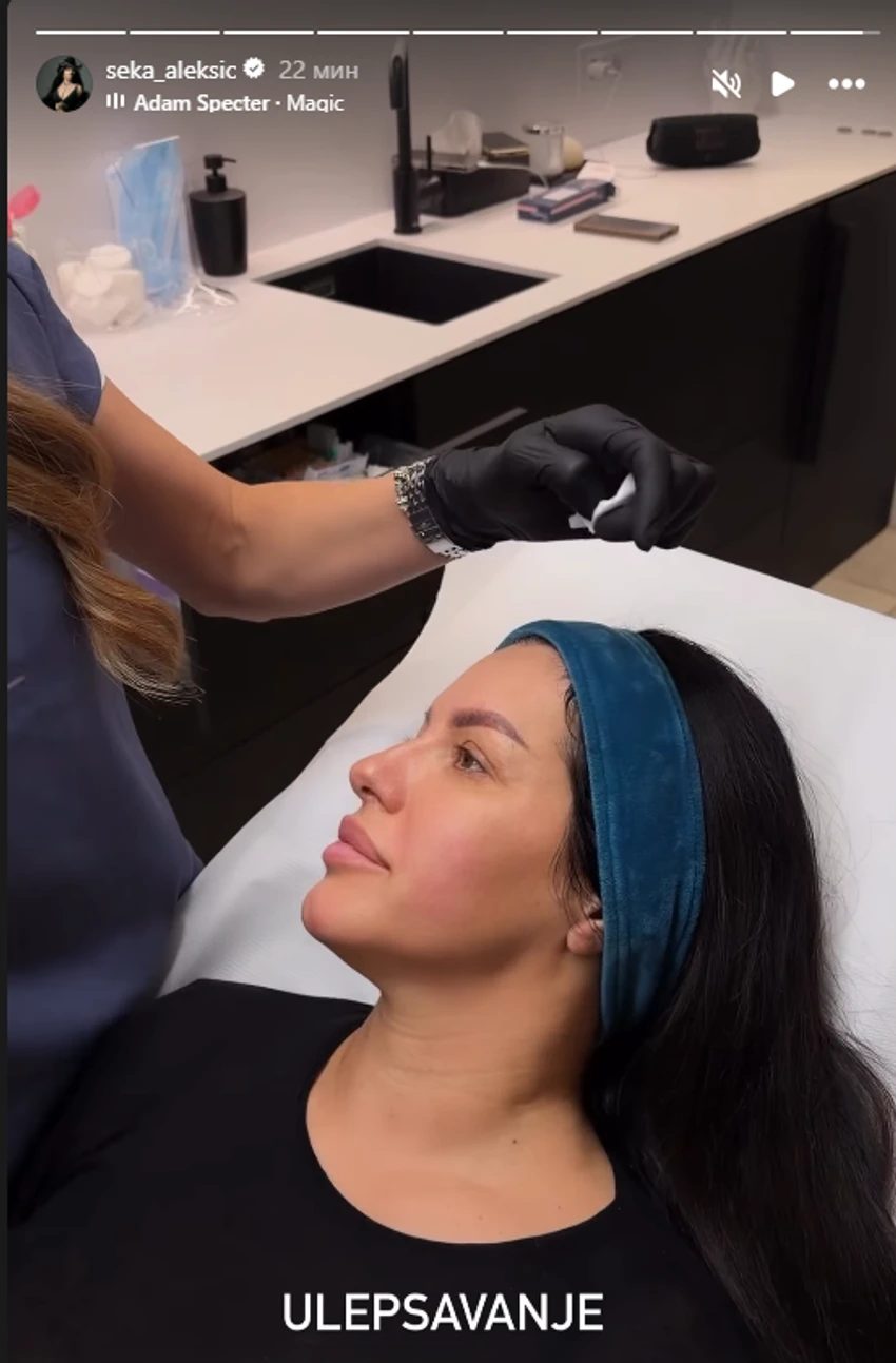 Seka Aleksić otišla da se podmladi, pokazala lice bez šminke FOTO 6 image 3 2