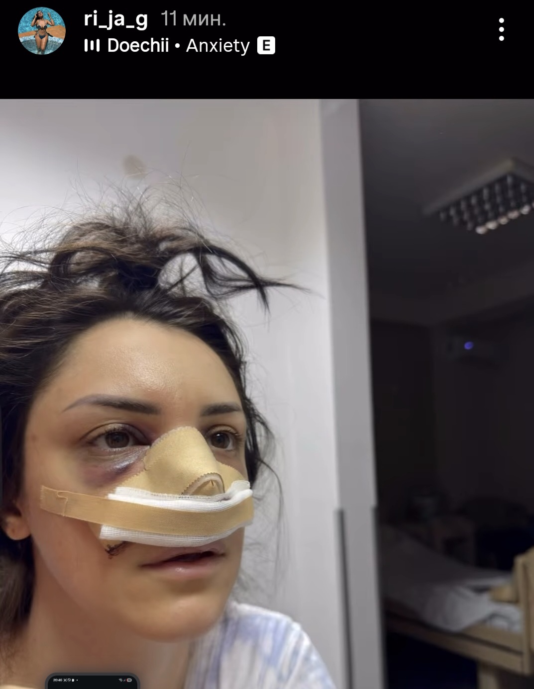 marija gruevska operisala nos