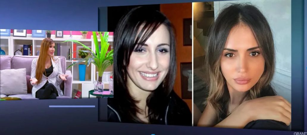 Pevačica drastično promenila izgled: Svi komentarišu da je ona najbolje iskoristila estetske korekcije FOTO 7 image 23