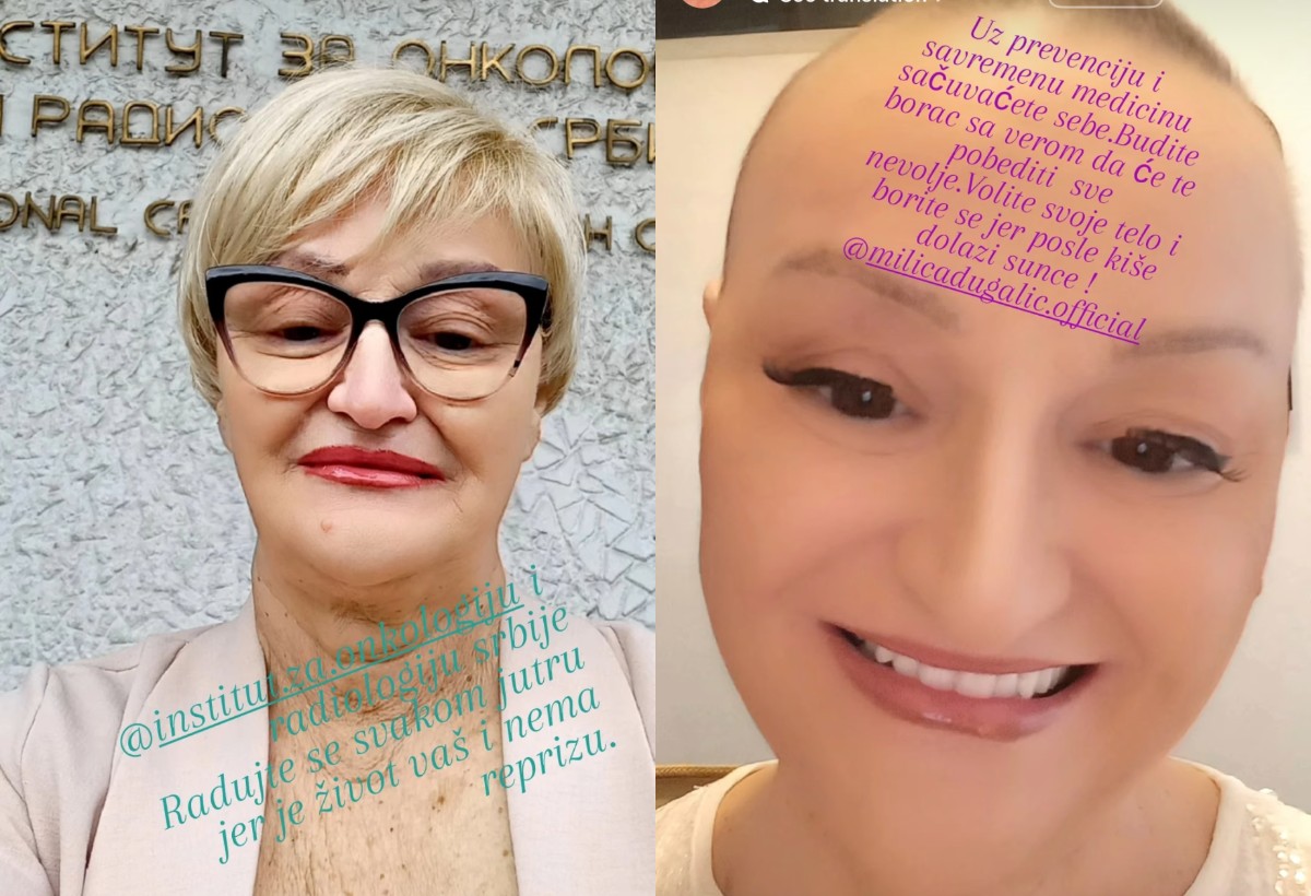 Pevačica pokazala kako izgleda njena borba sa karcinomom, njena objava rasplakala sve: "Život nema reprizu" 6 milica dugalic