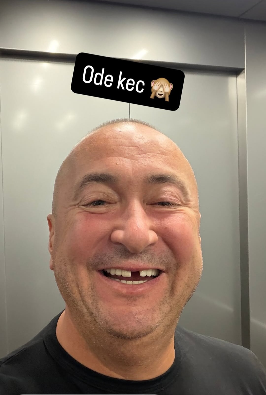 Još jedna nezgoda u folkerovom životu, Đani ostao bez zuba: "Ode kec" (FOTO) 6 Djani bez zuba
