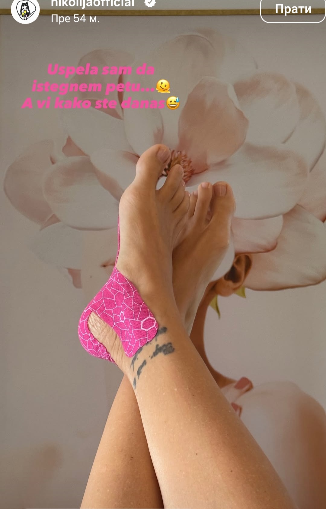 Povredila se Nikolija: Ćerka Vesne Zmijanac u flasterima, otkrila šta joj se desilo (FOTO) 6 Screenshot 20260810 133932 Instagram